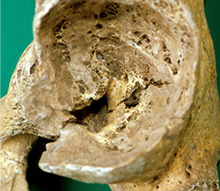 Anglo Saxon Hip