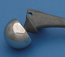 Bateman bipolar prosthesis