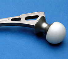 Early Ring Prosthesis