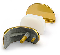 Unicompartmental Knee Replacement